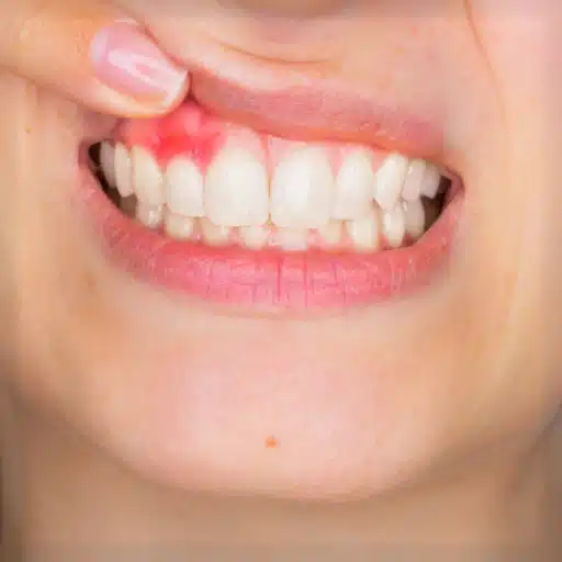 da7854d4 0351 4d28 a312 9dc4e443d088