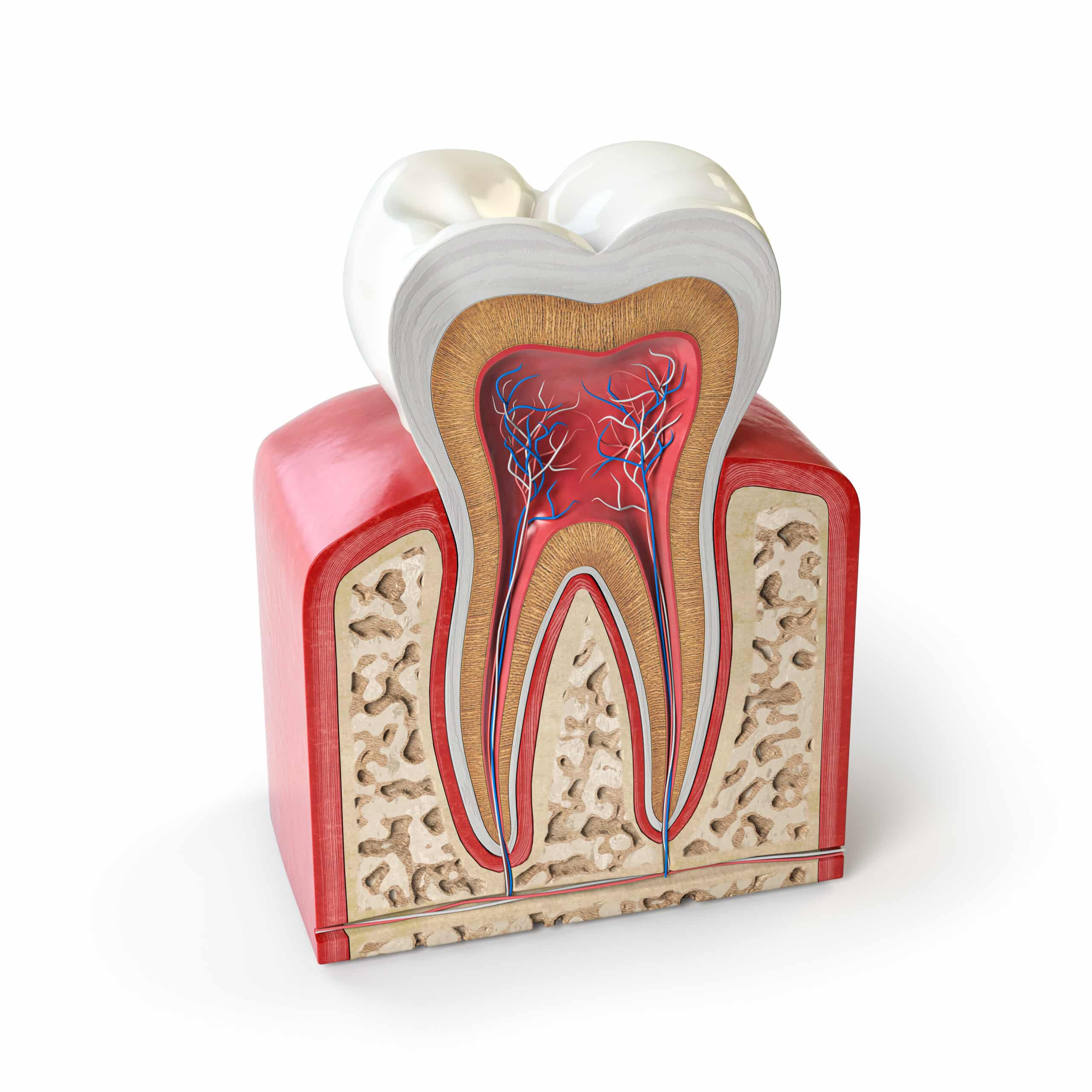 Drill Away Your Tooth Decay With Effective Root Canal Treatment