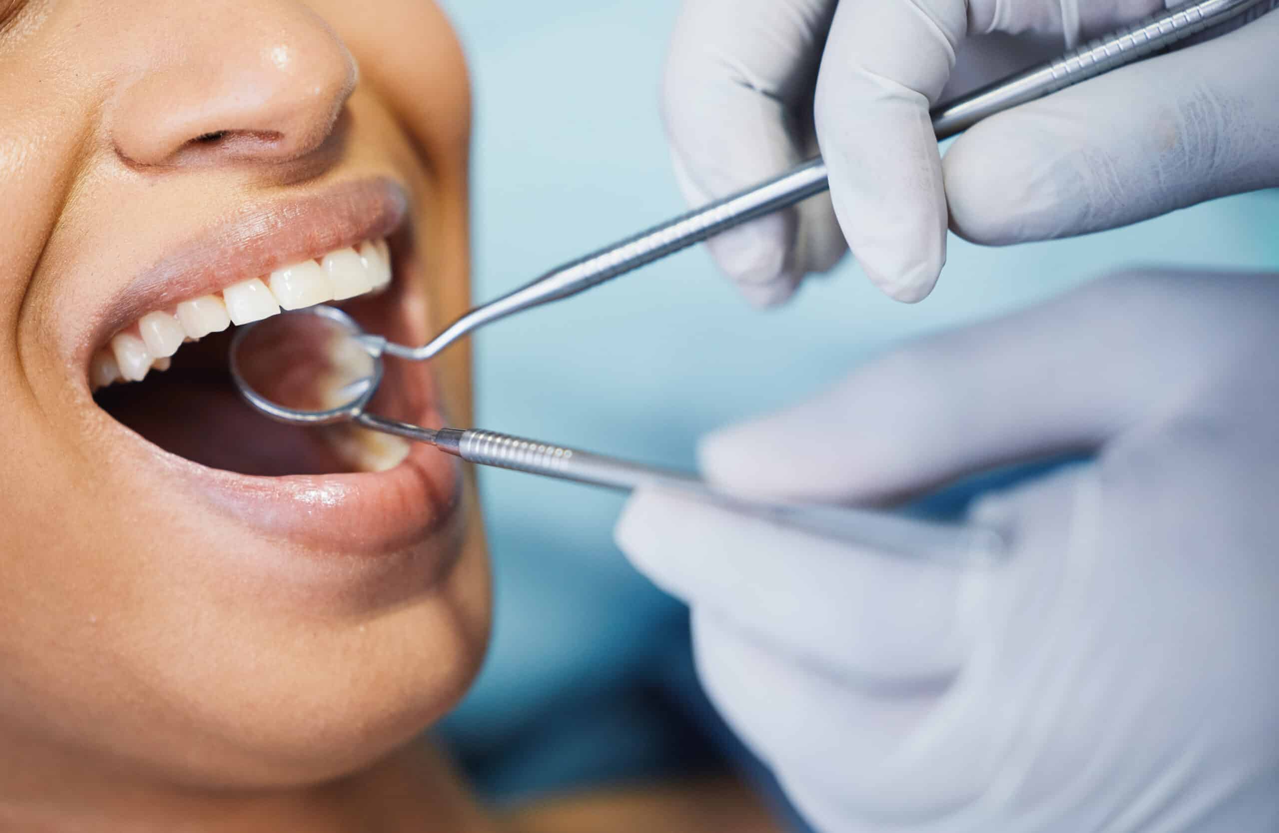 Gingivitis And Periodontitis: When To Get Your Gums Checked And Treated