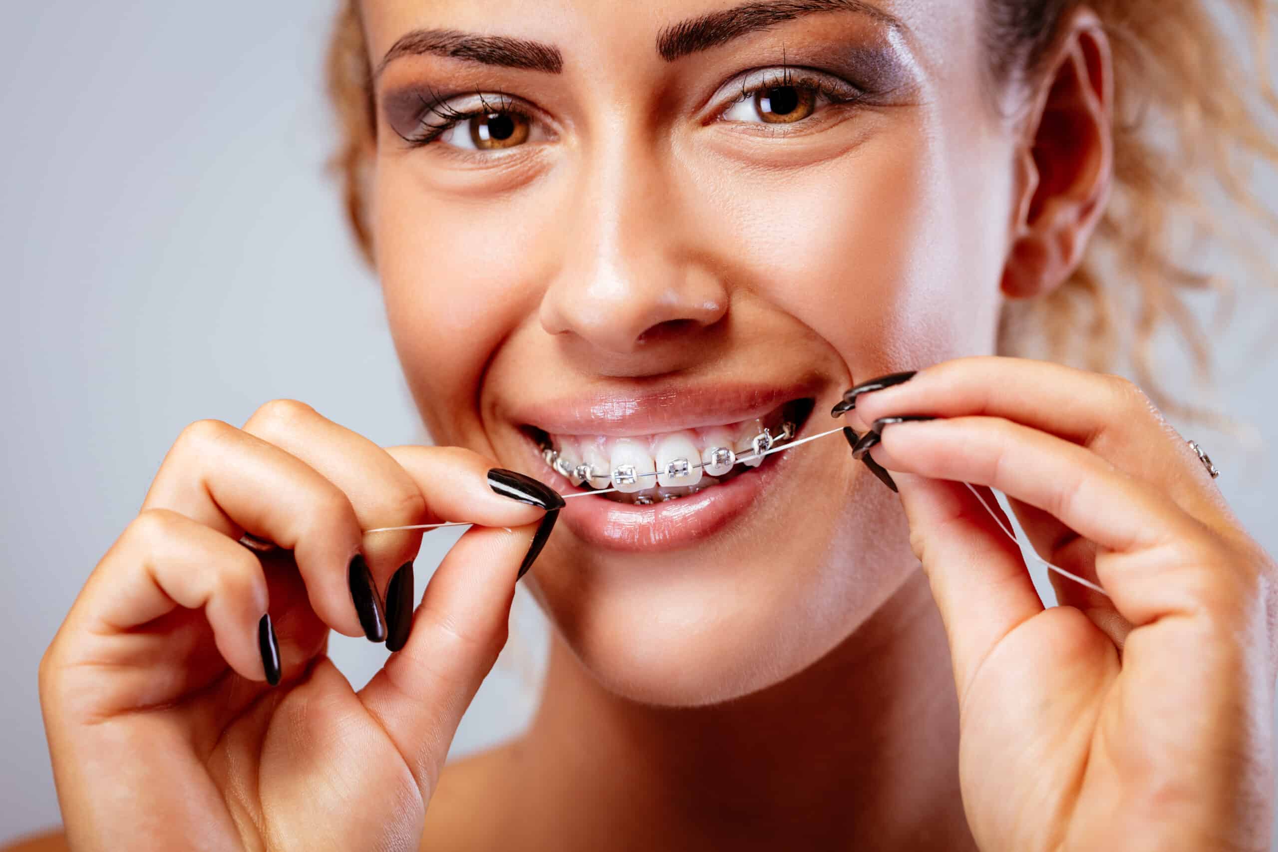 Living With Braces – How To Care For Them