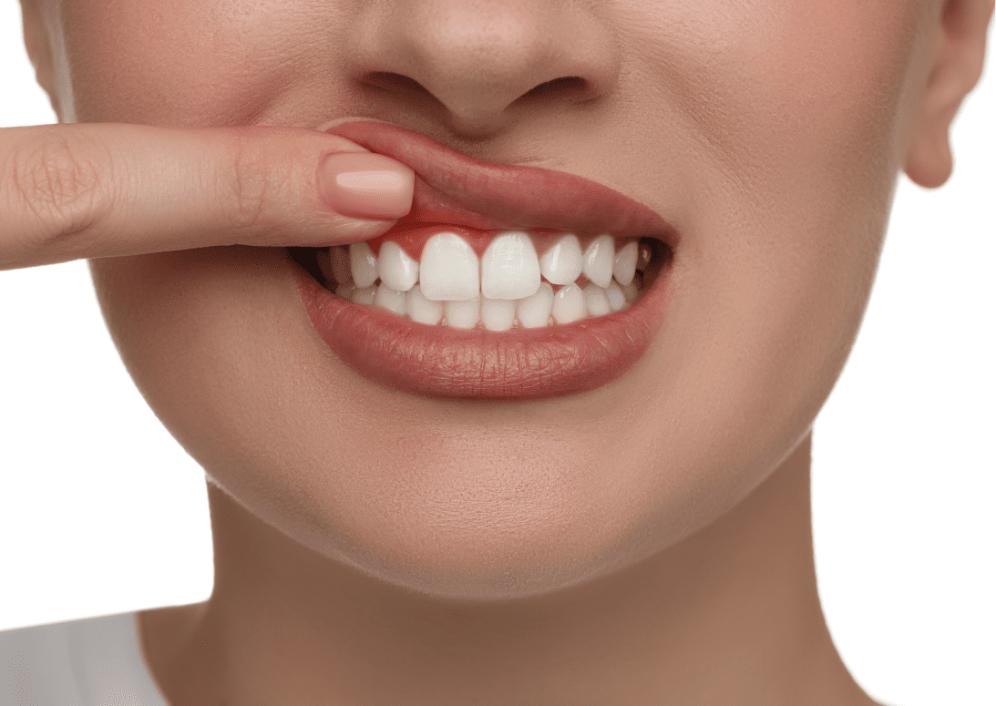 A Closer Look At The Causes Of Gum Recession That Can Be Corrected With Tissue Graft Surgery