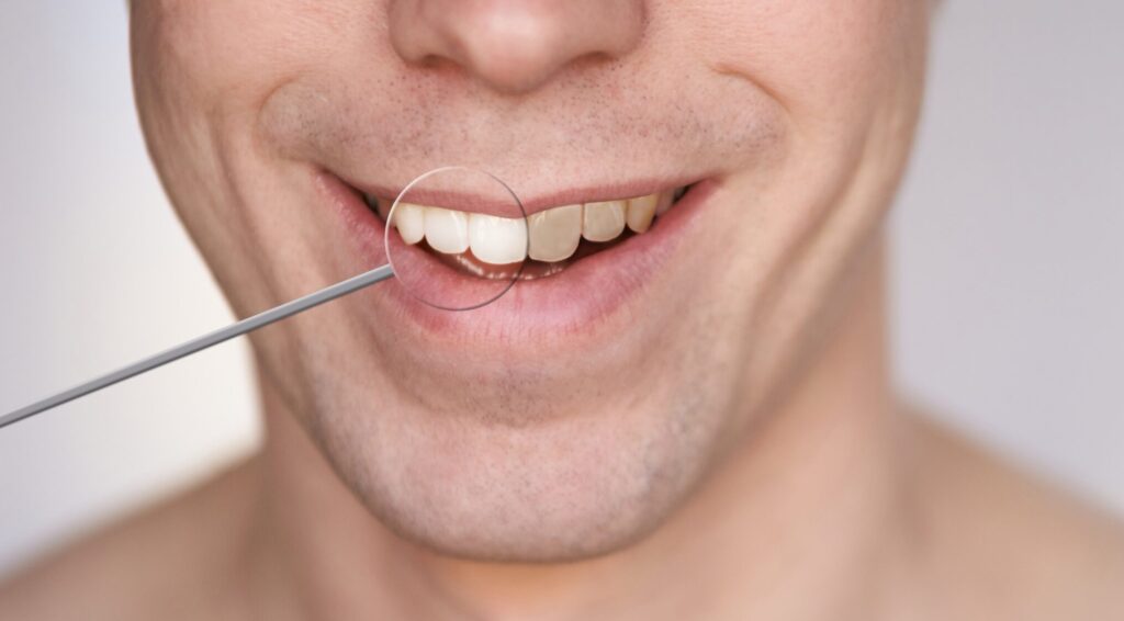 men smile male smiling person whitening oral car 2022 11 09 06 50 51 utc scaled e1698664601587