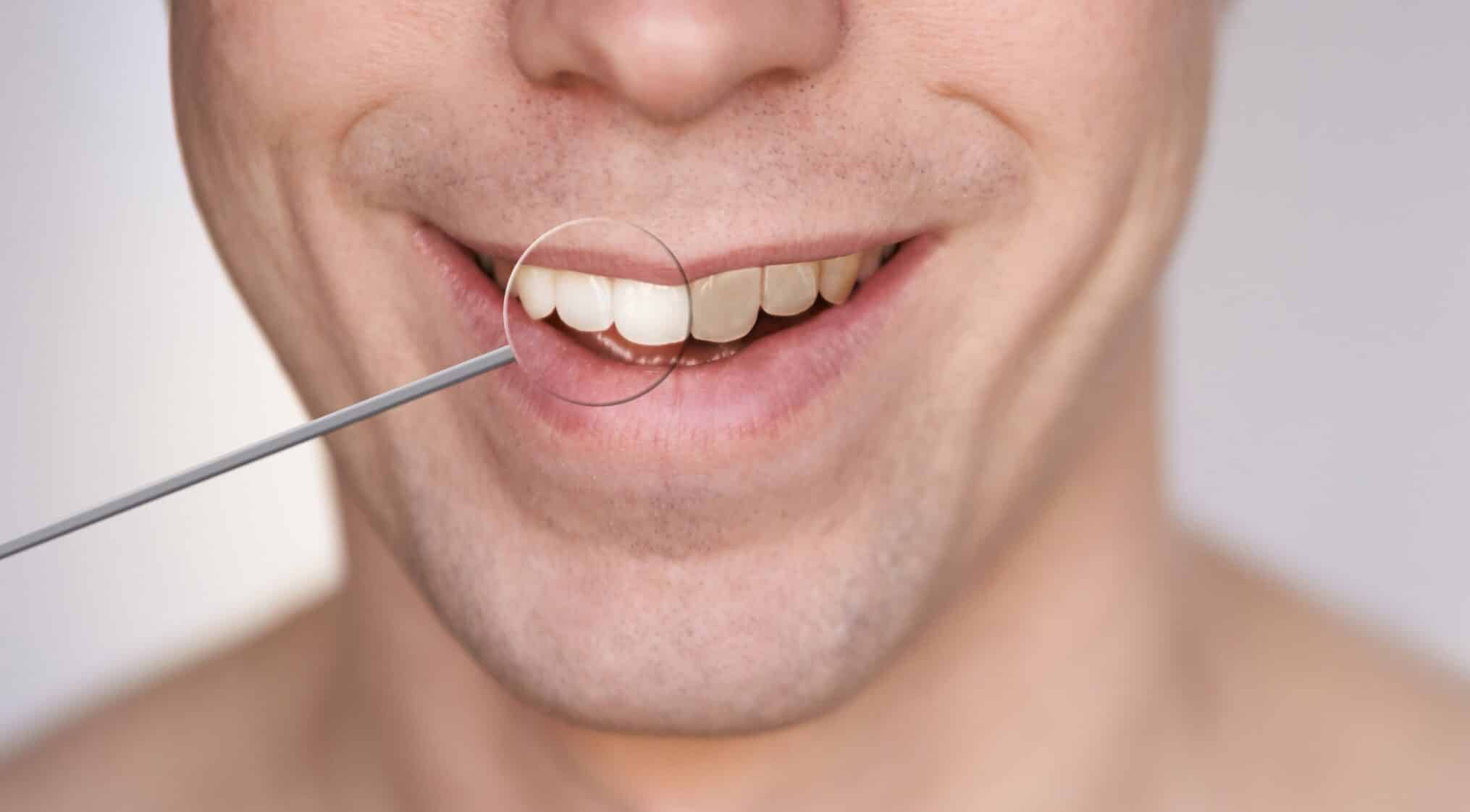 men smile male smiling person whitening oral car 2022 11 09 06 50 51 utc scaled e1698664601587