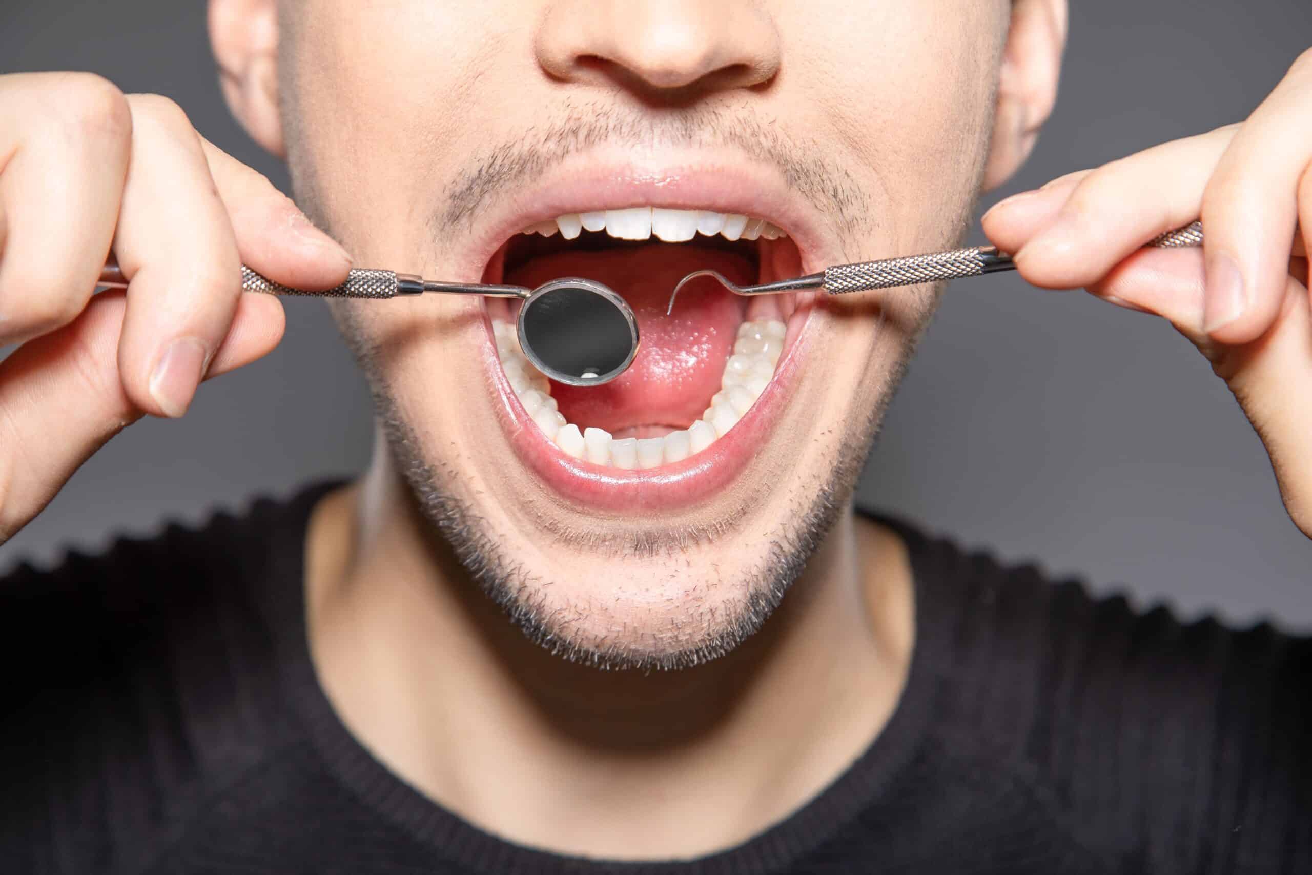 How Your Oral Health Can Help Determine Early Signs Of Type II Diabetes