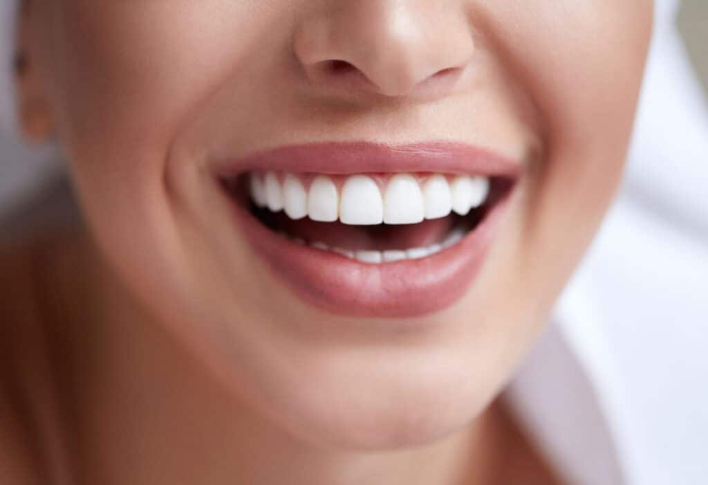 Dental Aesthetics Dubai