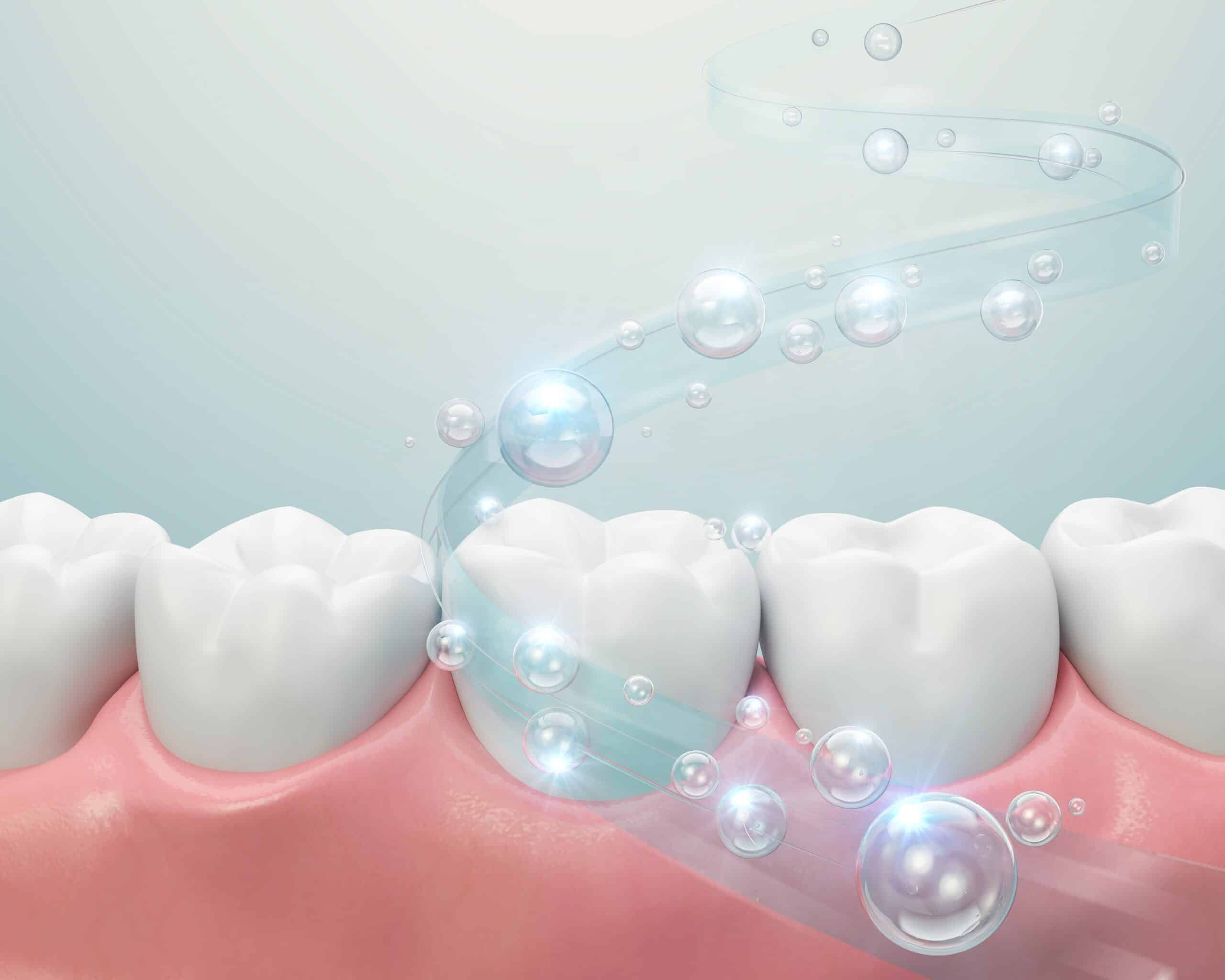 Ways to Help Reduce Plaque at Home